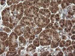 PI 3-Kinase p110 gamma Antibody (OTI2B1), Novus Biologicals 0.1mL; Unlabeled:Antibodies,