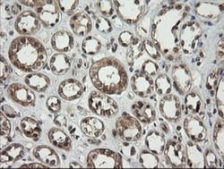 PI 3-Kinase p110 gamma Antibody (OTI2B1), Novus Biologicals 0.1mL; Unlabeled:Antibodies,