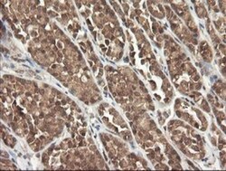 PI 3-Kinase p110 gamma Antibody (OTI2B1), Novus Biologicals 0.1mL; Unlabeled:Antibodies,