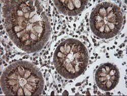 PI 3-Kinase p110 gamma Antibody (OTI2B1), Novus Biologicals 0.1mL; Unlabeled:Antibodies,