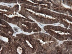 PI 3-Kinase p110 gamma Antibody (OTI2B1), Novus Biologicals 0.1mL; Unlabeled:Antibodies,