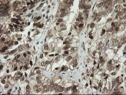 PI 3-Kinase p110 gamma Antibody (OTI2B1), Novus Biologicals 0.1mL; Unlabeled:Antibodies,