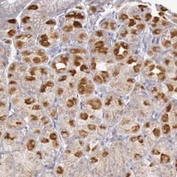 PI 3-Kinase p85 alpha Antibody, Novus Biologicals:Antibodies:Primary Antibodies