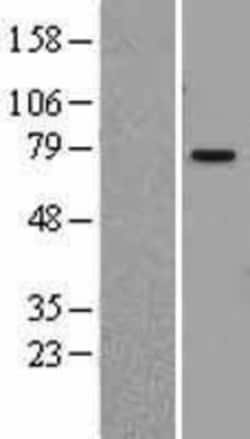 Novus Biologicals&trade;&nbsp;PIAS1 Overexpression Lysate