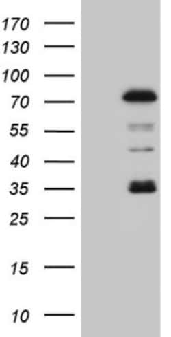 PIAS2 Antibody (OTI2B5), Novus Biologicals 0.1mL; Unlabeled:Antibodies,