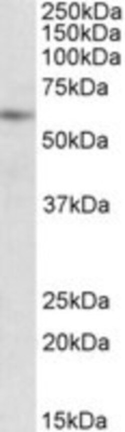 PIAS2 Antibody, Novus Biologicals 0.1mg; Unlabeled:Antibodies, Polyclonal