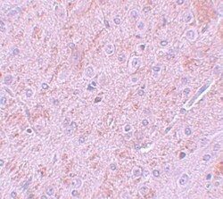 PIAS2 Antibody - BSA Free, Novus Biologicals 0.1mg; Unlabeled:Antibodies,