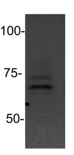PIAS2 Antibody, Novus Biologicals 0.1mg; Unlabeled:Antibodies, Polyclonal