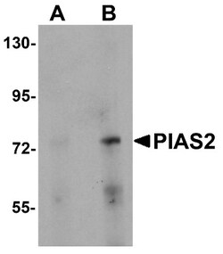 PIAS2 Antibody - BSA Free, Novus Biologicals 0.1mg; Unlabeled:Antibodies,