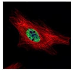 PIASy Antibody, Novus Biologicals 0.1mg; Unlabeled:Antibodies, Polyclonal