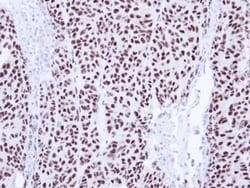 PIASy Antibody, Novus Biologicals 0.1mg; Unlabeled:Antibodies, Polyclonal