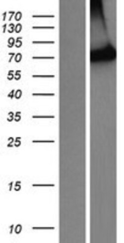 Novus Biologicals™ PIB5PA Overexpression Lysate