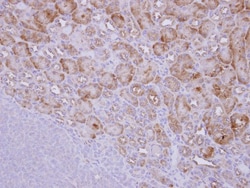 PICALM Antibody, Novus Biologicals 0.1mL; Unlabeled:Antibodies, Polyclonal