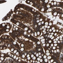 PICALM Antibody, Novus Biologicals:Antibodies:Primary Antibodies