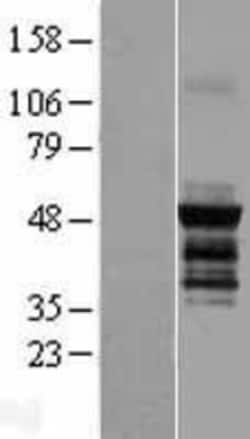 Novus Biologicals™ PICK1 Overexpression Lysate