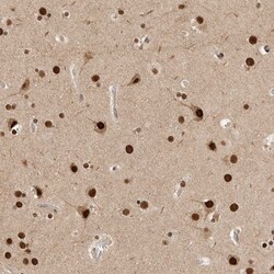 PIG13 Antibody, Novus Biologicals:Antibodies:Primary Antibodies