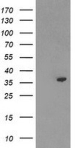 PIG3 Antibody (OTI3B11), Novus Biologicals 0.1 mL | Buy Online | Novus Biologicals | Fisher Scientific
