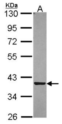 PIG3 Antibody, Novus Biologicals 0.1mL; Unlabeled:Antibodies, Polyclonal