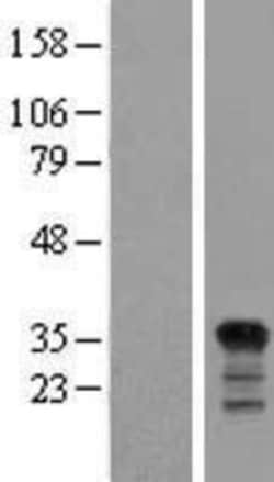 Novus Biologicals&trade;&nbsp;PIG3 Overexpression Lysate