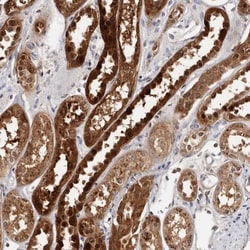 PIG3 Antibody, Novus Biologicals 25 &mu;L | Buy Online | Novus Biologicals | Fisher Scientific