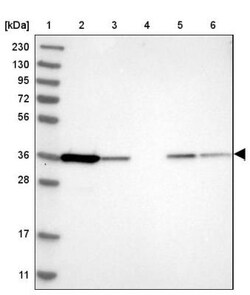 PIG3 Antibody, Novus Biologicals:Antibodies:Primary Antibodies