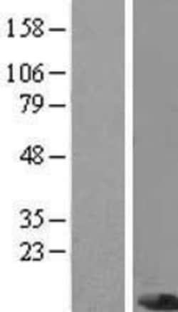 Novus Biologicals&trade;&nbsp;PIGC Overexpression Lysate