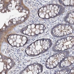PIGC Antibody, Novus Biologicals 0.1mL; Unlabeled:Antibodies, Polyclonal