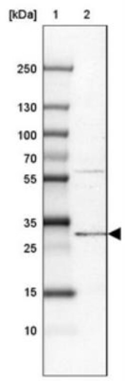 PIGC Antibody, Novus Biologicals 0.1mL; Unlabeled:Antibodies, Polyclonal