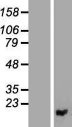 Novus Biologicals&trade;&nbsp;PIGF Overexpression Lysate