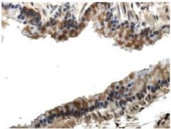 PIGF Antibody (RM0010-8F09) - Azide and BSA Free, Novus Biologicals:Antibodies:Primary