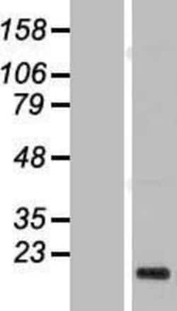 Novus Biologicals PIGH Overexpression Lysate 0.1 mg | Buy Online | Novus Biologicals&trade; | Fisher Scientific