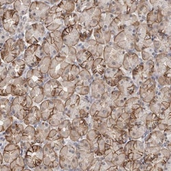 PIGP Antibody, Novus Biologicals:Antibodies:Primary Antibodies
