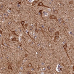 PIGQ Antibody, Novus Biologicals 25 &mu;L; Unlabeled:Antibodies, Polyclonal