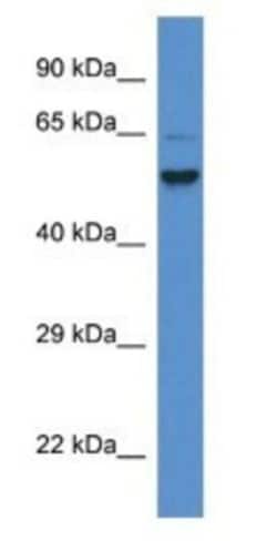 PIGS Antibody, Novus Biologicals:Antibodies:Primary Antibodies
