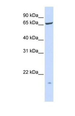 PIGT Antibody, Novus Biologicals 0.05mg; Unlabeled:Antibodies, Polyclonal