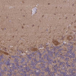 PIGZ Antibody, Novus Biologicals 0.1mL; Unlabeled:Antibodies, Polyclonal