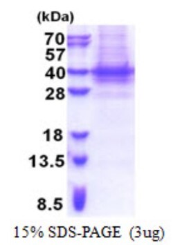 Novus Biologicals&trade;&nbsp;Recombinant Human PIH1D1 His Protein