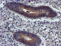PIH1D2 Antibody (OTI4A10), Novus Biologicals 0.1mL; Unlabeled:Antibodies,