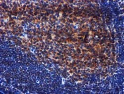 PIH1D2 Antibody (OTI4A10), Novus Biologicals 0.1mL; Unlabeled:Antibodies,
