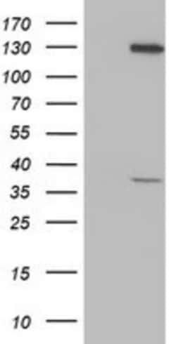 PIH1D2 Antibody (OTI4A10), Novus Biologicals 0.1mL; Unlabeled:Antibodies,