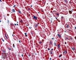 PIK3C2A Antibody, Novus Biologicals 0.1mg; Unlabeled:Antibodies, Polyclonal