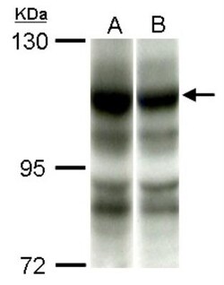 PIK3CA Antibody, Novus Biologicals 0.1mL; Unlabeled:Antibodies, Polyclonal