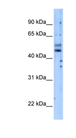 PI 3-Kinase p55 gamma Antibody, Novus Biologicals 100 ul; Unconjugated:Antibodies,