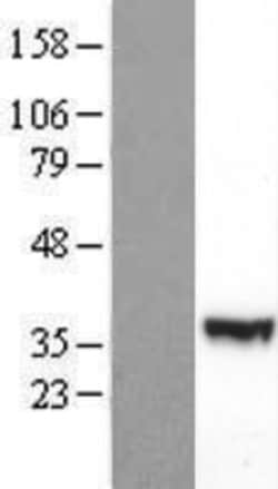 Novus Biologicals&trade;&nbsp;PI 3-Kinase p55 gamma Overexpression Lysate