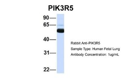 PIK3R5 Antibody, Novus Biologicals 20&mu;L; Unlabeled:Antibodies, Polyclonal