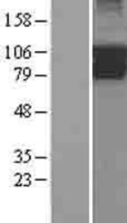 Novus Biologicals&trade;&nbsp;PIK3R5 Overexpression Lysate