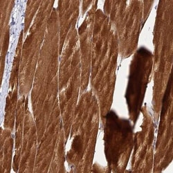 PIKFyve/PIP5K3 Antibody, Novus Biologicals 0.1mL; Unlabeled:Antibodies,