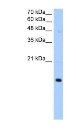 PILR-alpha Antibody, Novus Biologicals 100&mu;L; Unlabeled:Antibodies,