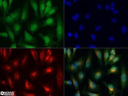 PIM1 Antibody, Novus Biologicals 0.1mg; Unlabeled:Antibodies, Polyclonal
