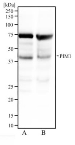 PIM1 Antibody, Novus Biologicals 0.1mg; Unlabeled:Antibodies, Polyclonal
